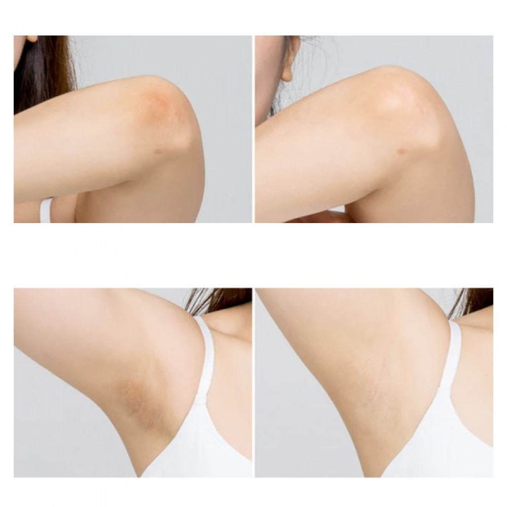 Многофункциональные осветляющие пэды для тела - Celimax One Step Body Brightening Pad фото 3