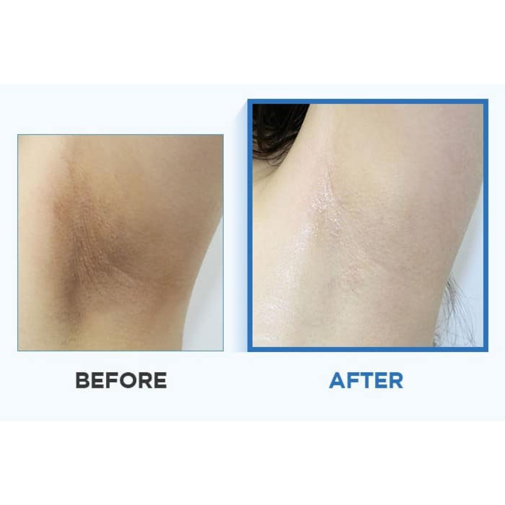 Многофункциональные осветляющие пэды для тела - Celimax One Step Body Brightening Pad фото 2