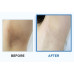 Многофункциональные осветляющие пэды для тела - Celimax One Step Body Brightening Pad фото 2