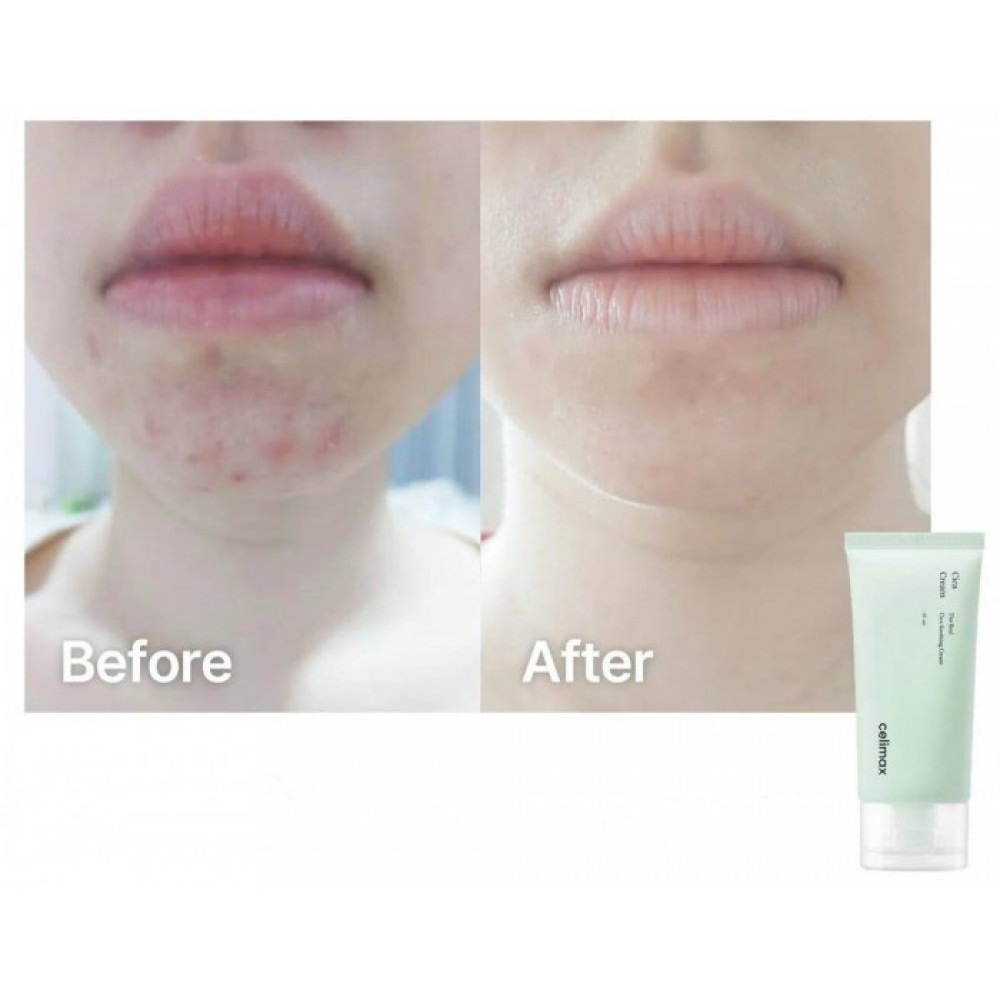 Заспокійливий крем для обличчя з азіатською центеллою - Celimax The Real Cica Soothing Cream фото 2