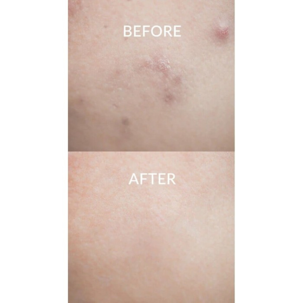 Заспокійливий крем для обличчя – Dr. Althea Pro Lab 147 Barrier Cream фото 2