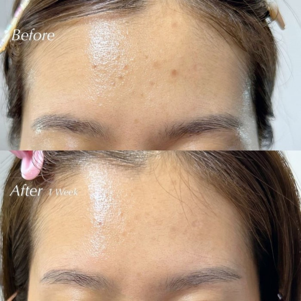Укрепляющая сыворотка для лица с витамином С - Dr. Althea Vitamin C Boosting Serum фото 4