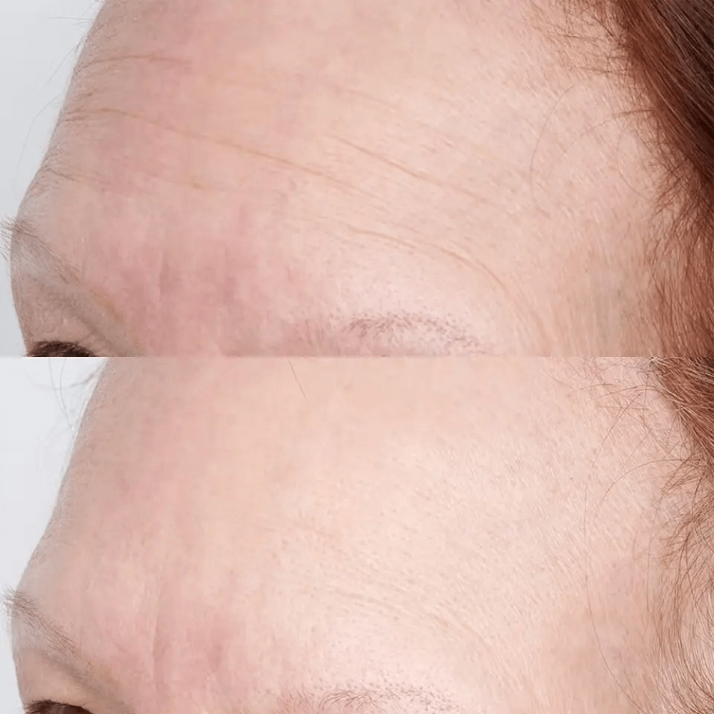 Интенсивная увлажняющая маска - Perricone MD High Potency Hyaluronic Intensive Hydrating Mask фото 4