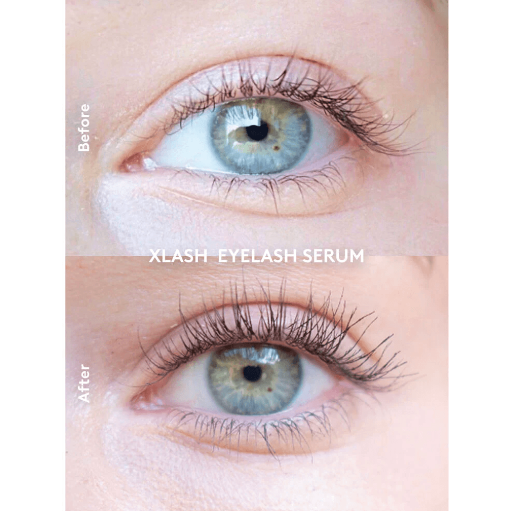 Сыворотка для стимуляции роста ресниц - Xlash Eyelash Serum фото 4