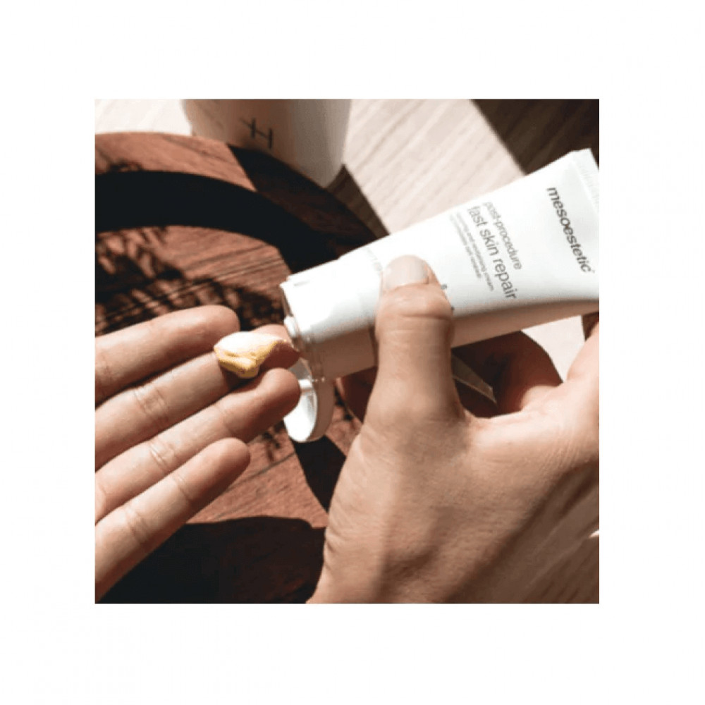 Крем восстанавливающий кожу после процедур - Mesoestetic Post-procedure Fast Skin Repair фото 4