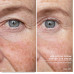 Ліфтинг-сироватка - Babor HSR Lifting Serum фото 4